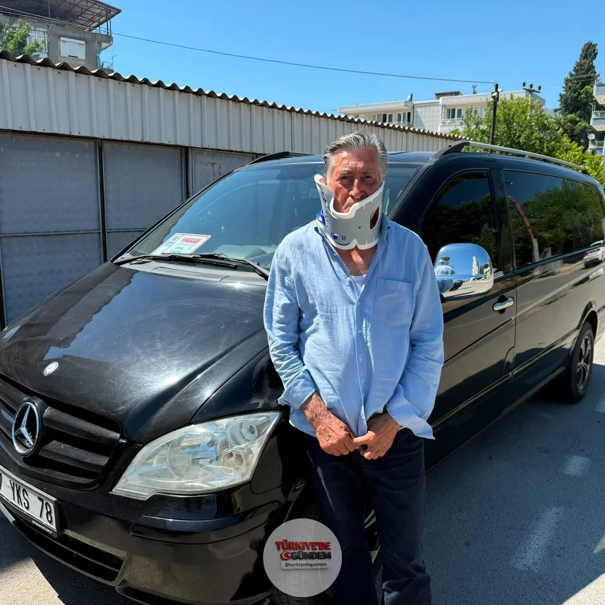 Antalya’da transfer şoförü, telefon şarjı yüzünden tartıştığı Litvanyalı boksör yolcunun saldırısına uğradı