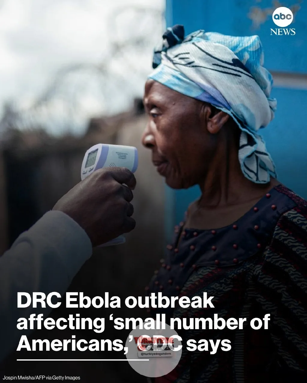 ABD Hastalık Kontrol ve Önleme Merkezleri (CDC) Pazar günü yaptığı açıklamada, Demokratik Kongo Cumhuriyeti'nde meydana gelen Ebola salgınından "az sayıda Amerikalının" doğrudan etkilendiğini bildirdi. Devamı: