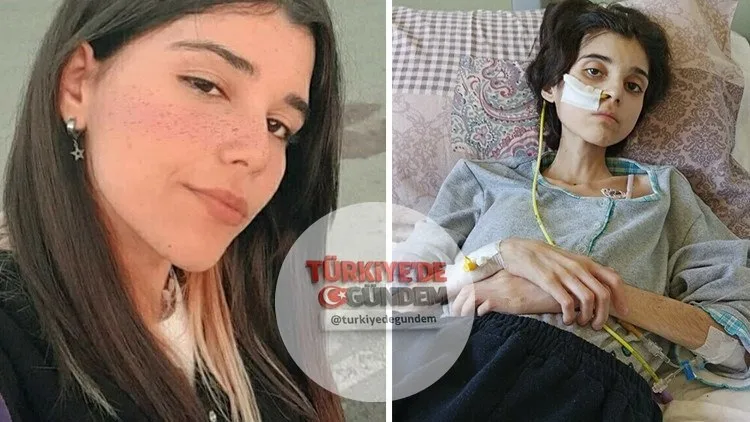 İzmir'de ince bağırsak tümörü ameliyatı sonrası protein emilim bozukluğu yaşayan 17 yaşındaki Ünzile Naz Gümüştaş, 65 kilodan 30 kiloya kadar düştü. Kızının yüksek proteinli mama ile beslenmesinin hayati önem taşıdığını belirten çaresiz anne: "Kızımı