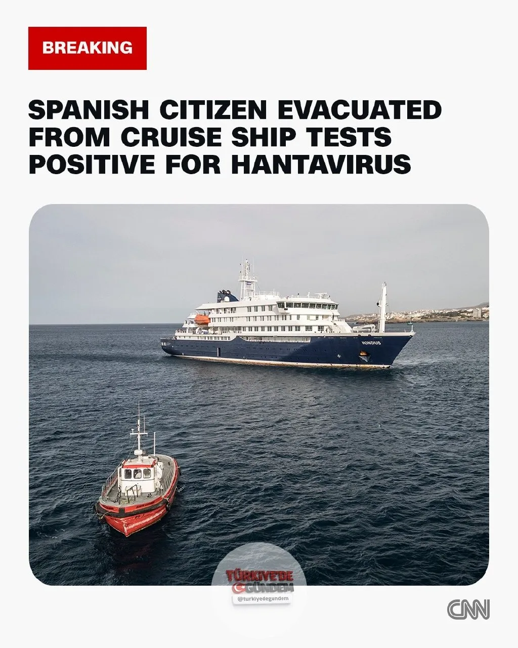 İspanya Sağlık Bakanlığı, MV Hondius gemisinden tahliye edilen ve Madrid'deki bir hastanede karantinaya alınan bir İspanya vatandaşının hantavirüs testinin pozitif çıktığını açıkladı.