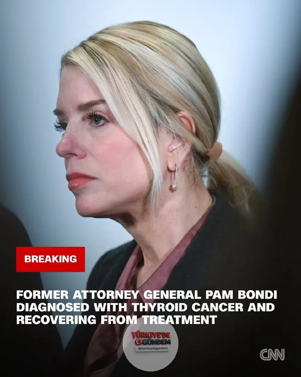 Pam Bondi, tiroid kanseri tedavisi sonrası iyileşme sürecinde. Eski başsavcıya, nisan ayında Adalet Bakanlığı'ndan ayrılmasının ardından teşhis konulmuştu.
