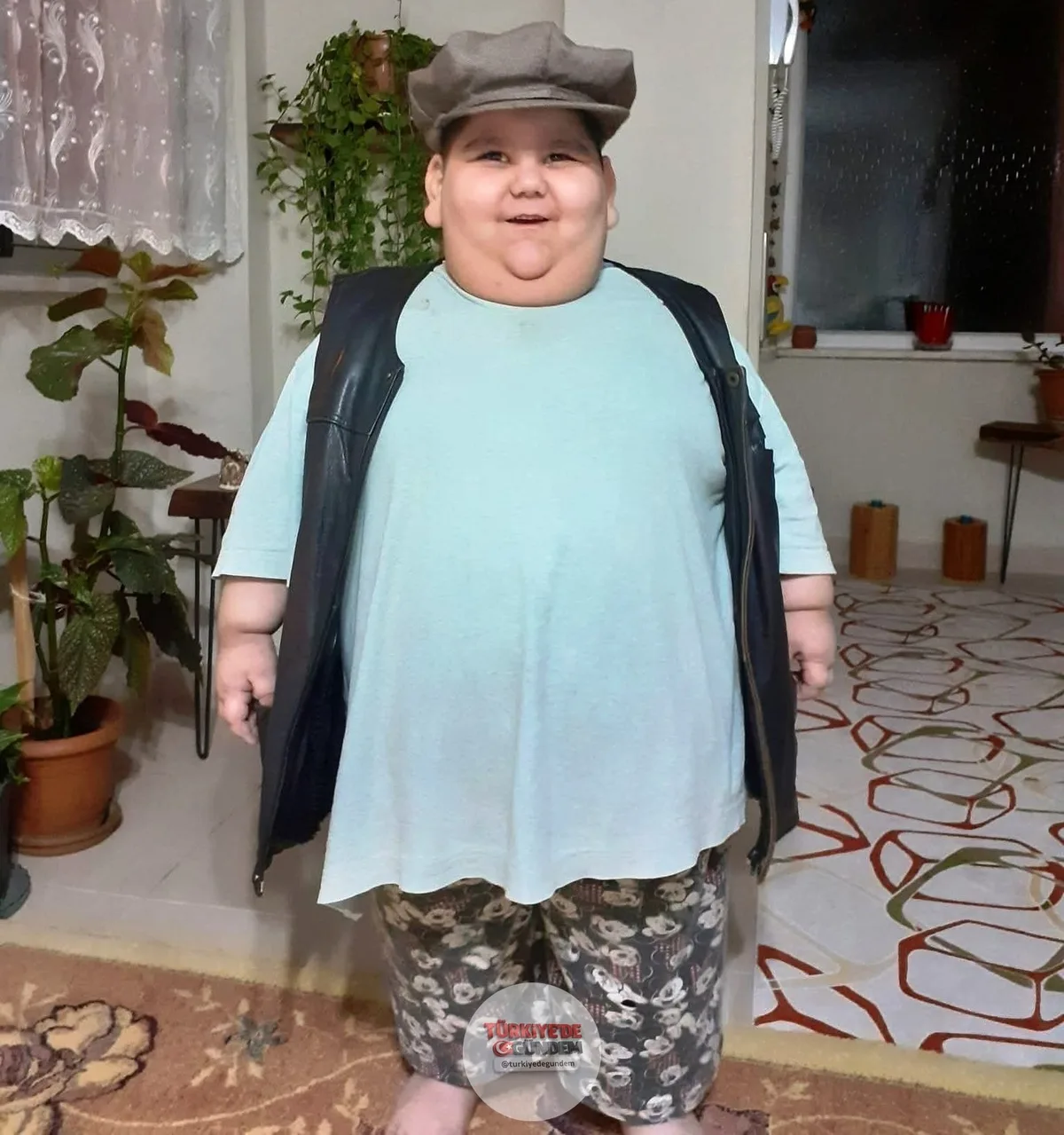 Samsun'da doğuştan gelen ve tokluk hissetmesini engelleyen leptin hormonu eksikliği nedeniyle 5 yaşında 90 kiloya ulaşan Yağız Bekte, uygulanan tedavi sayesinde 11 yaşında 40 kiloya düştü.