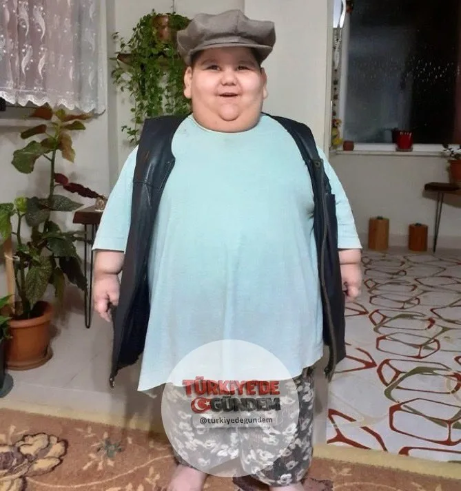 Samsun'da doğuştan gelen ve tokluk hissini engelleyen leptin hormonu eksikliği nedeniyle 5 yaşında 90 kiloya ulaşan Yağız, uygulanan tedavi sayesinde 11 yaşında 40 kiloya düştü.