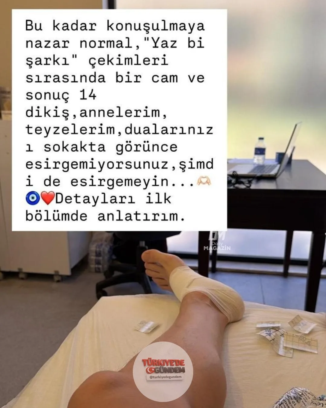 Sinan Akçıl, ayağına 14 dikiş atıldığını belirterek talihsiz kazasını “nazar” diyerek paylaştı
