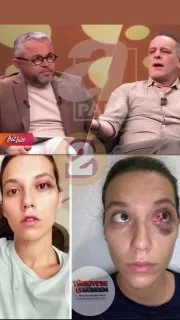 Ozan Güven, Deniz Bulutsuz’a şiddet uyguladığı gerekçesiyle hüküm giydiği geceye dair açıklamalarda bulundu. Güven, "Lambayla boynunu çizmişim. Birini lambayla yaralamaktan ceza aldım. Ona dokunmadım bile; bu her an herkesin başına gelebilir, hayatın