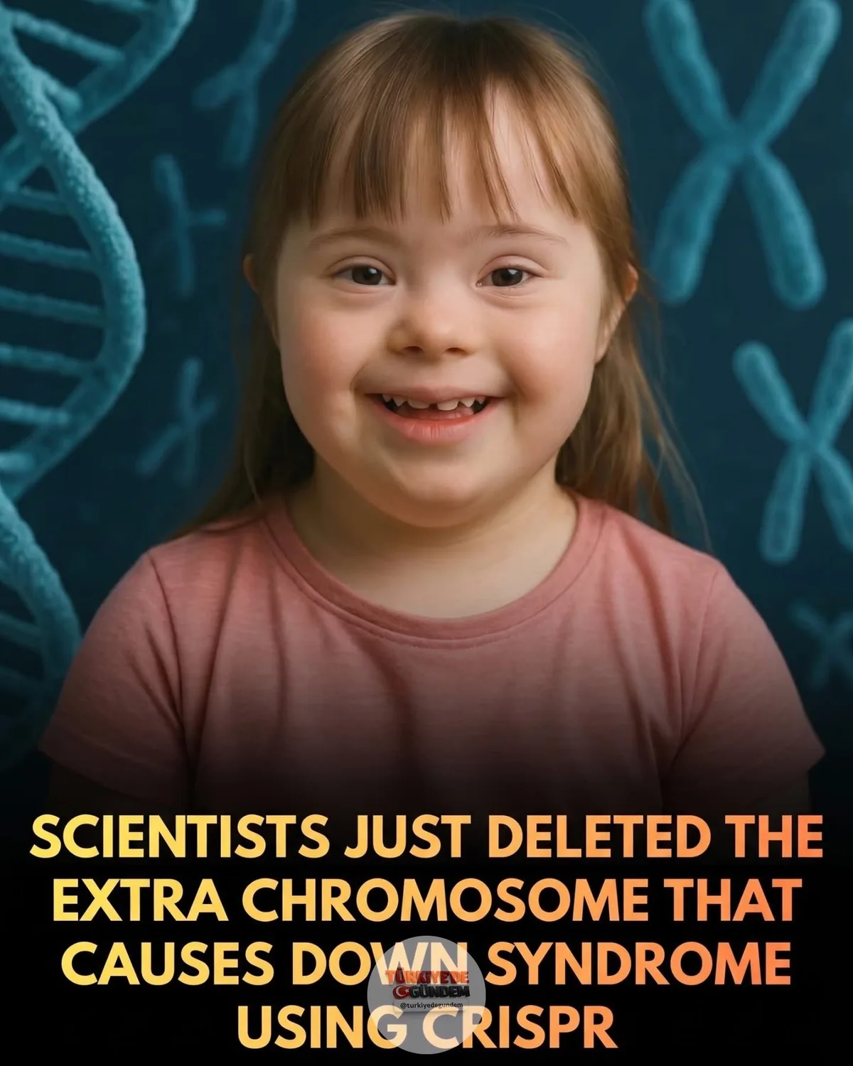 1-) 🏥 Bilim insanları, CRISPR gen düzenleme teknolojisini kullanarak Down sendromuna neden olan fazladan kromozomu insan hücrelerinden temizledi. Dr. Ryotaro Hashizume liderliğindeki araştırma ekibi, sendromun gelişimsel ve bilişsel zorluklarından so