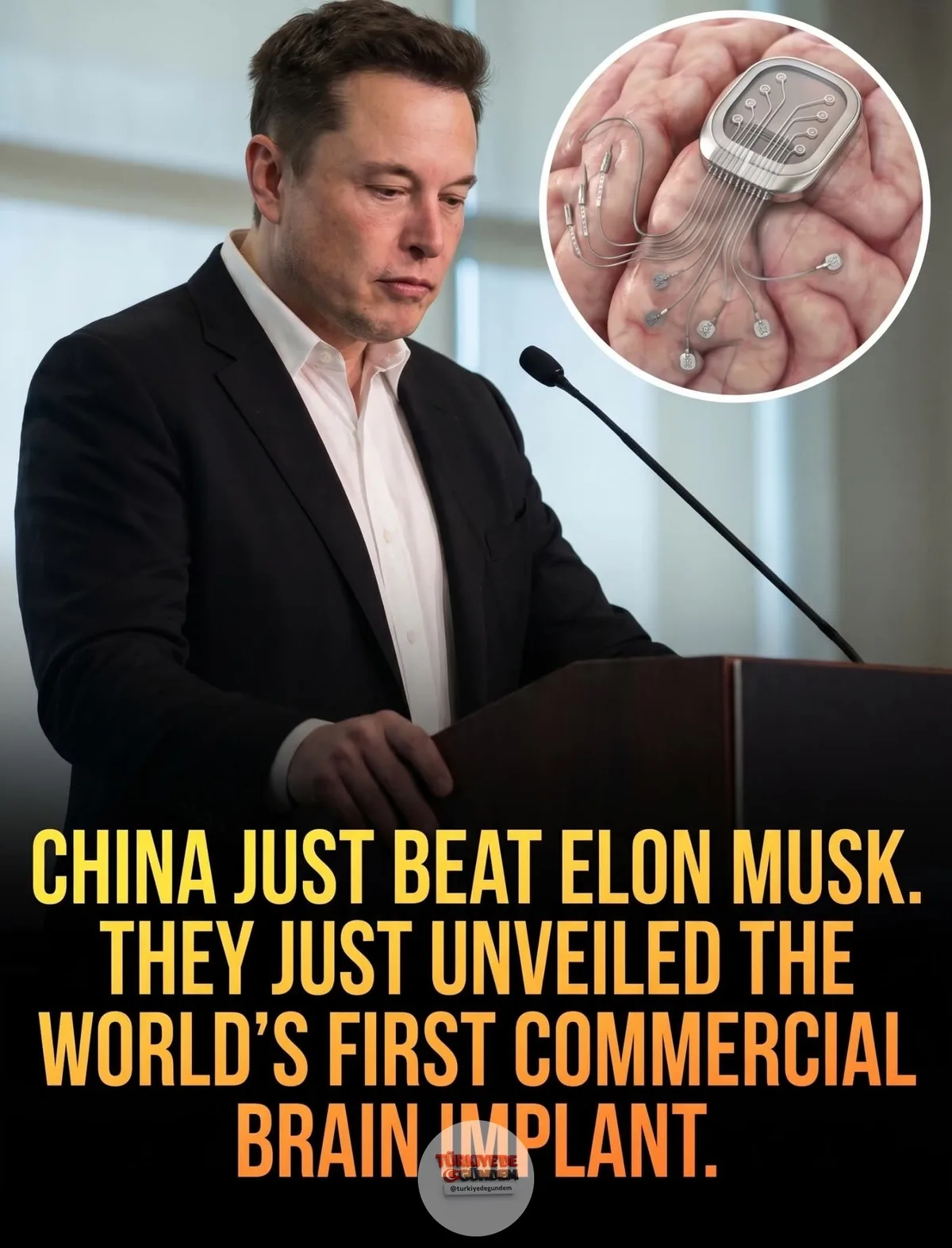 1-) 🏥 Çin, dünyanın ilk ticari beyin implantına onay verdi. Çin, Elon Musk’ın Neuralink şirketini geride bırakarak dünyanın ilk ticari invaziv beyin-bilgisayar arayüzünü (BCI) resmen onayladı. Tsinghua Üniversitesi araştırmacıları ve Şanghay merkezli