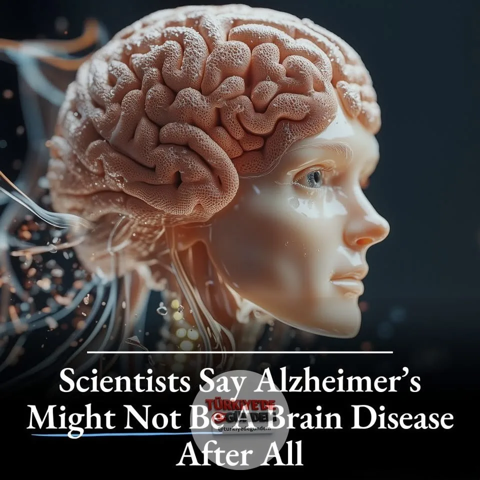 1-) 🏥 Alzheimer hastalığının beyindeki plaklardan kaynaklandığına dair yerleşik teori artık sorgulanıyor. Bilim insanları, Alzheimer'ı beynin savunma sisteminin sağlıklı hücrelere yanlışlıkla saldırdığı bir otoimmün hastalık olarak yeniden tanımlayar