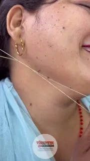 Yüzdeki siyah noktaların iple temizlendiği o anlar;