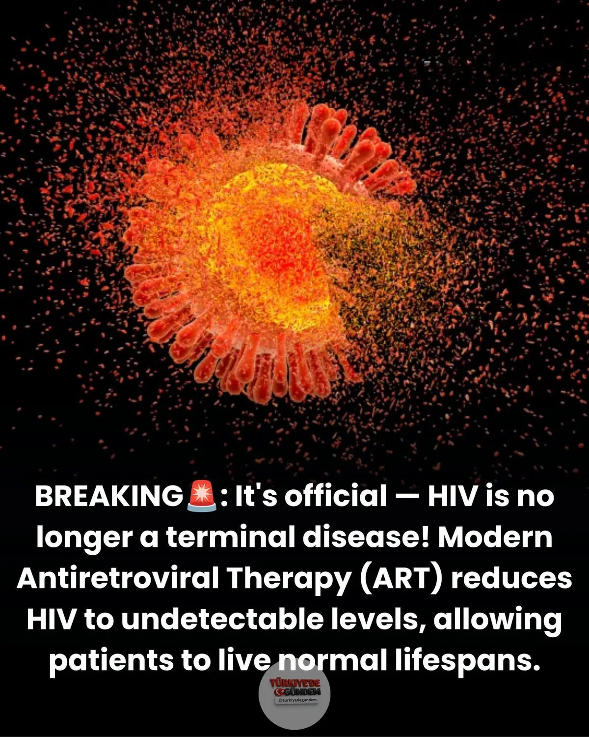 1-) 🏥 Bir zamanlar ölüm fermanı anlamına gelen bir virüs, günümüzde kan testlerinde neredeyse hiç görünmüyor ve çoğu insan bu hikayenin ne kadar köklü bir şekilde değiştiğinin farkında değil. Salgının ilk günlerinde HIV teşhisi, acımasız bir zaman çi