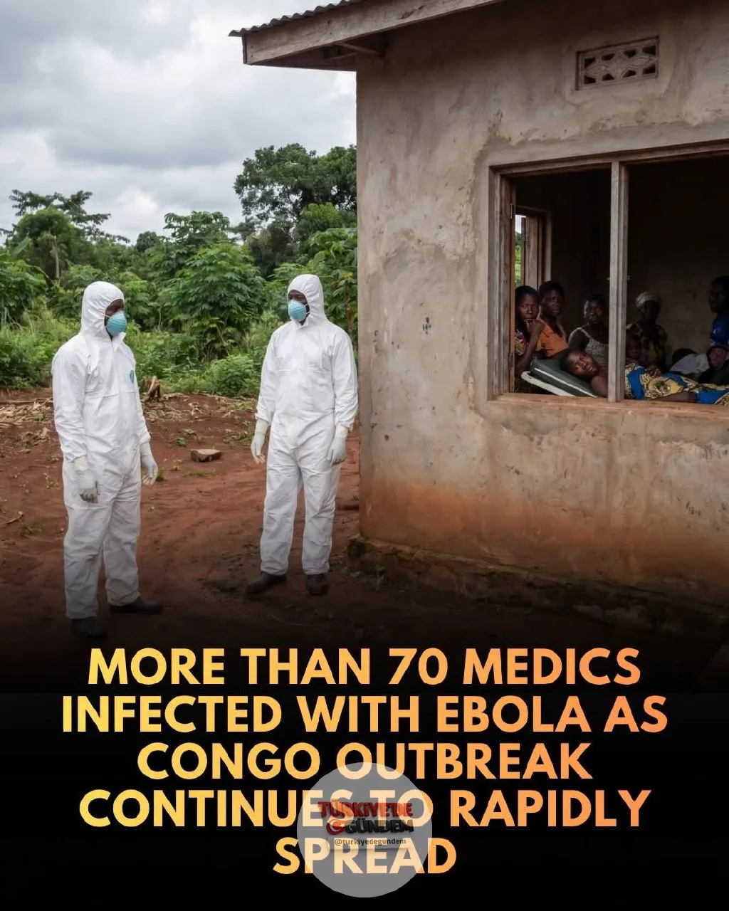 1-) 🌍 Kongo'da hızla yayılan Ebola salgını, onlarca sağlık çalışanına bulaştı. Demokratik Kongo Cumhuriyeti'nin (DRC) doğusundaki Ebola salgını, şiddet olayları, kitlesel göçler ve kritik düzeydeki fon yetersizliklerinin kontrol altına alma çabaların