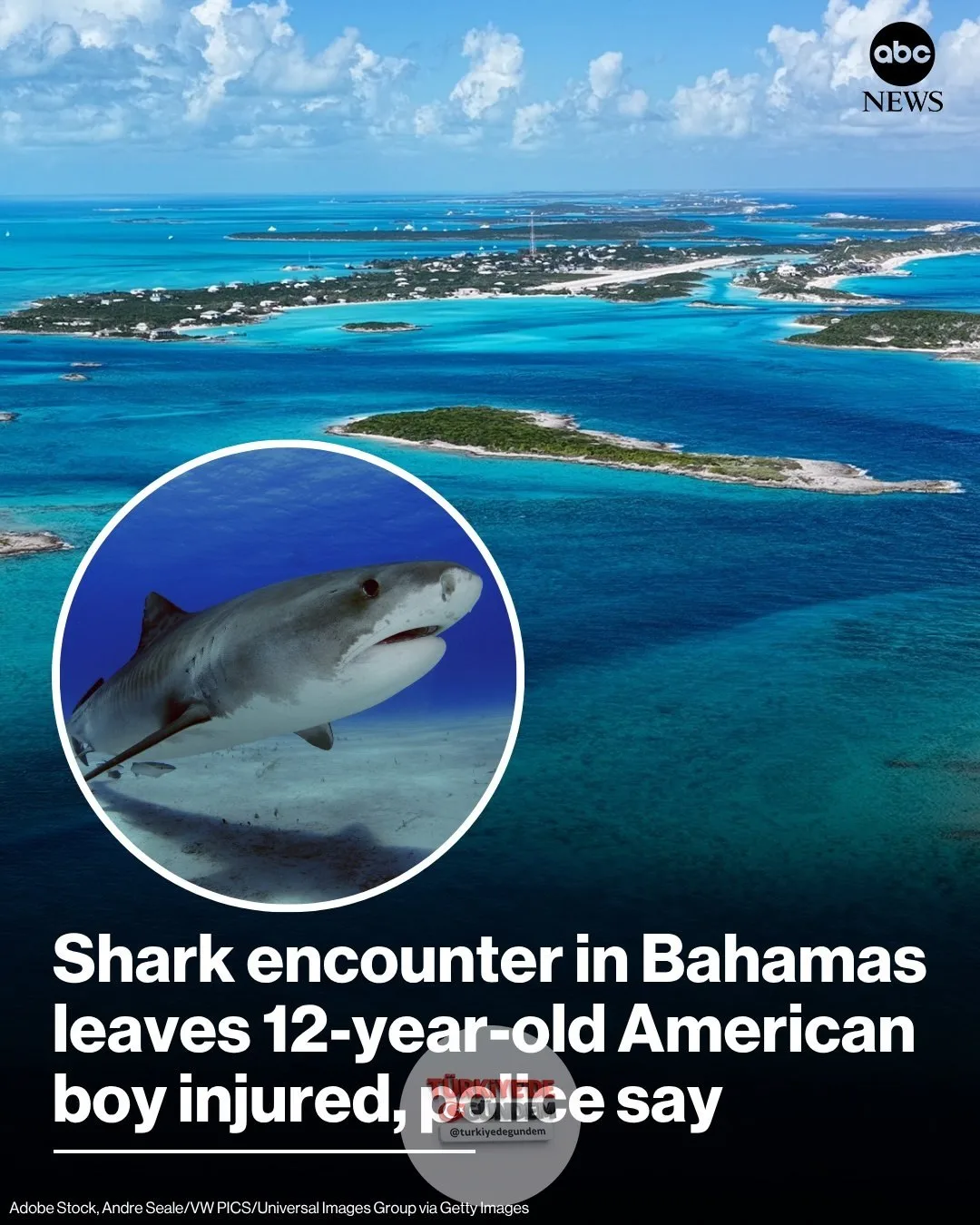 Bahamalar Kraliyet Polis Teşkilatı tarafından çarşamba günü yapılan açıklamada, 12 yaşındaki bir Amerikalı çocuğun bu hafta Bahamalar'da katıldığı bir tur sırasında köpek balığı saldırısına uğrayarak yaralandığı bildirildi.