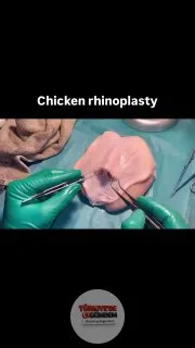 Bir doktor, tavuk göğsü üzerinde rinoplasti ameliyatı yaptı
