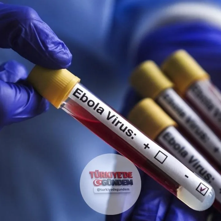 Fransa'da ilk Ebola vakası tespit edildi. Virüs, Demokratik Kongo Cumhuriyeti'nden Fransa'ya dönen bir doktorda saptandı.