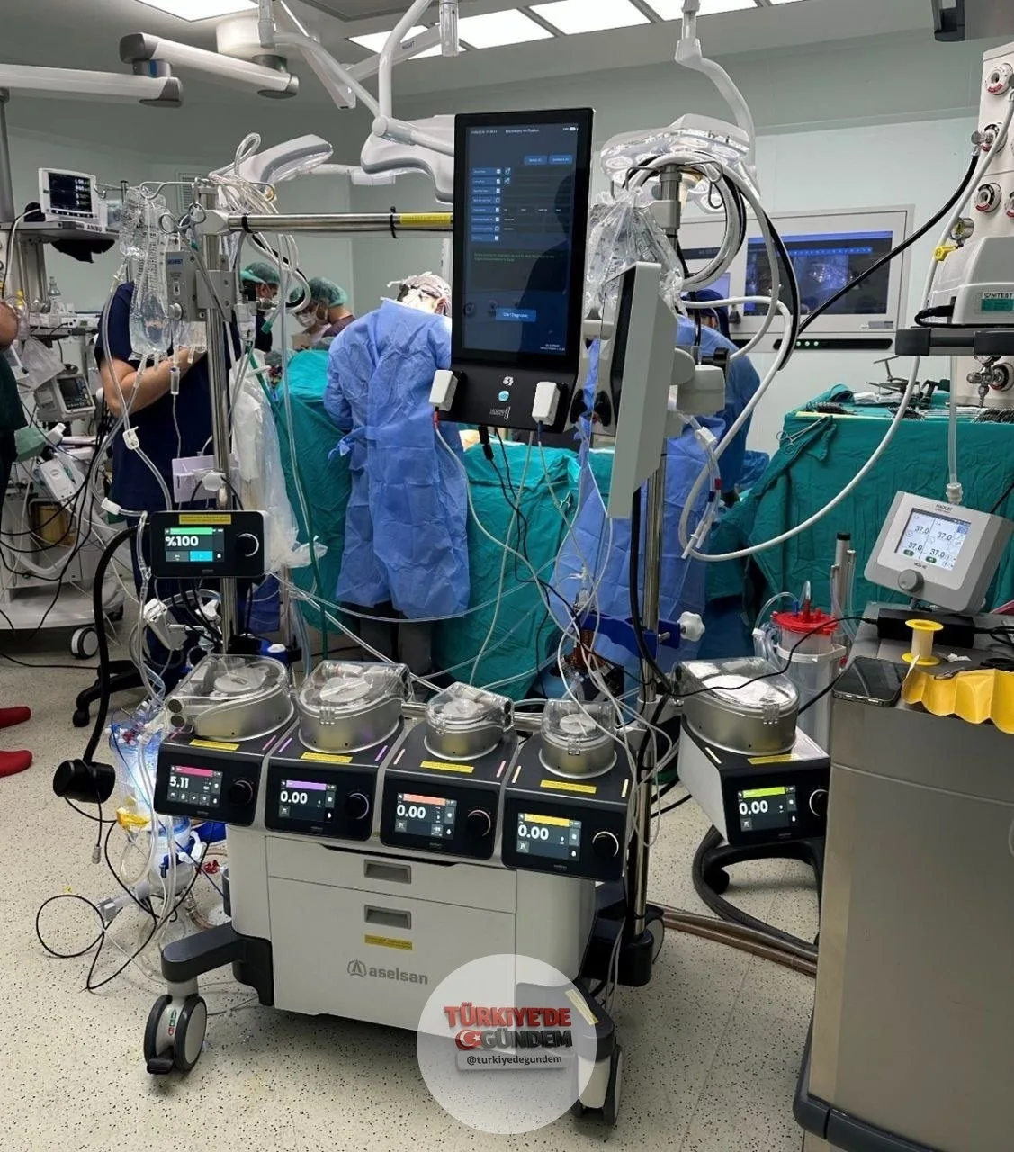 SON DAKİKA ASELSAN: Türkiye'nin ilk yerli üretim Kalp-Akciğer Pompası ASELSAN LIFELINE HLM, ilk başarılı kalp ameliyatını gerçekleştirdi. ASELSAN LIFELINE HLM, cerrahi operasyon boyunca hastanın dolaşım ve oksijenasyon fonksiyonlarını güvenli ve kesi