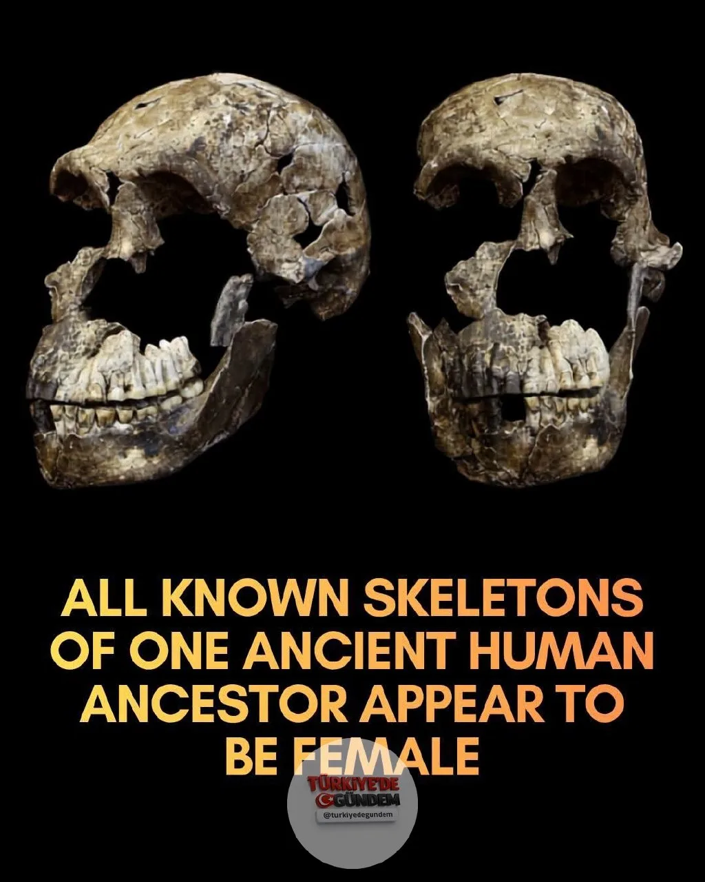 1-) 📰 Yeni bir analiz, Homo naledi türüne ait 20 bireyin tamamının dişi olduğunu ortaya koydu. Güney Afrika'daki Rising Star Mağarası, 2013 yılındaki keşfinden bu yana, antik insan kuzenimiz Homo naledi üzerine yoğun tartışmalara konu oluyordu. Bilim