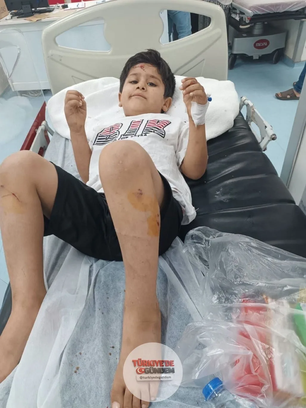 Şanlıurfa'da 8 yaşındaki bir çocuk, sokak köpeklerinin saldırısı sonucu yaralandı. Bakan Çiftçi, olayla ilgili idari müfettiş görevlendirdi. (Burak Doğan)